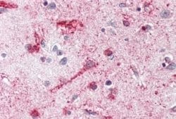 Melanocortin-4 R Antibody, Novus Biologicals 50 &mu;g; Unconjugated:Antibodies,